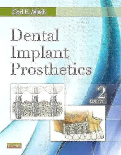 Dental Implant Prosthetics Elsevier Mosby
