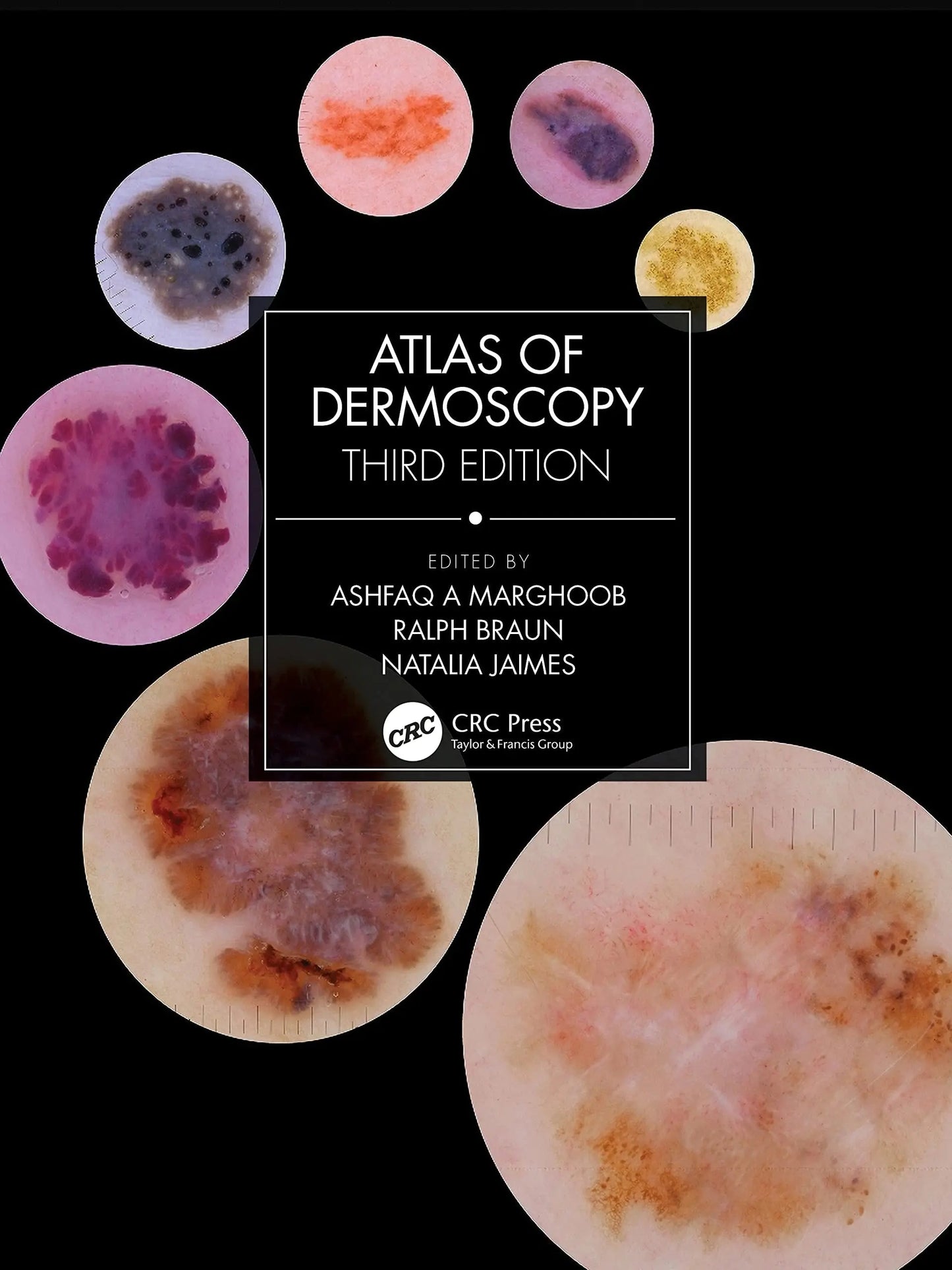 Atlas of Dermoscopy by Ashfaq A. Marghoob – book cover