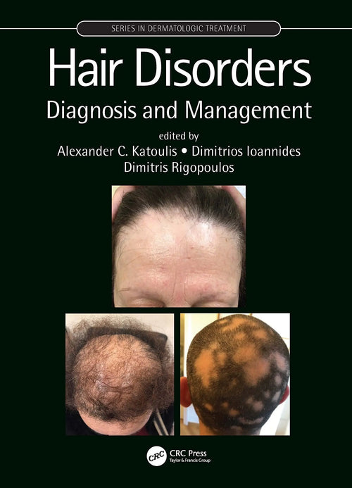 Hair Disorders Diagnosis and Management by Alexander C. Katoulis