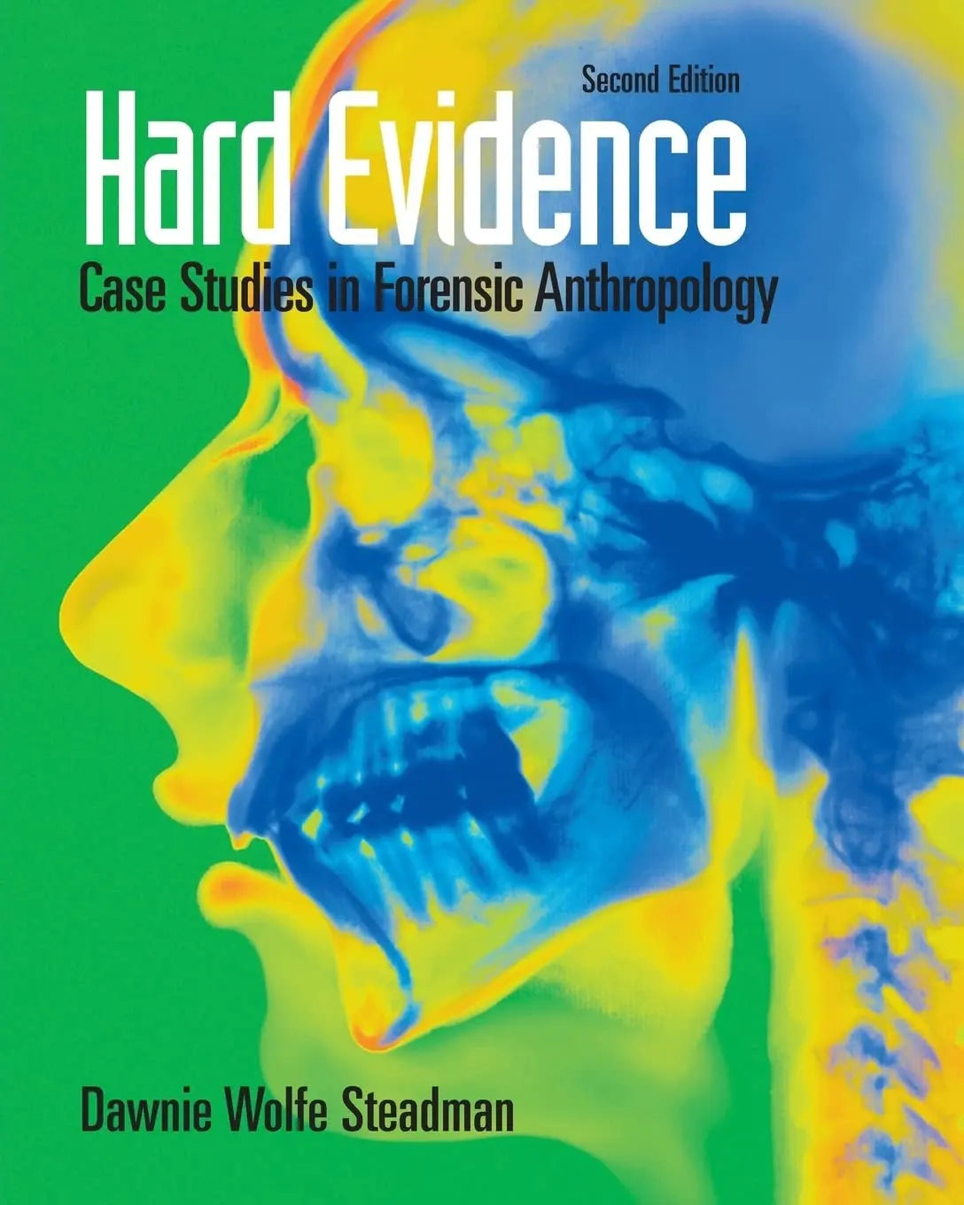 Hard Evidence Case Studies in Forensic Anthropology by Dawnie Wolfe Steadman – book cover