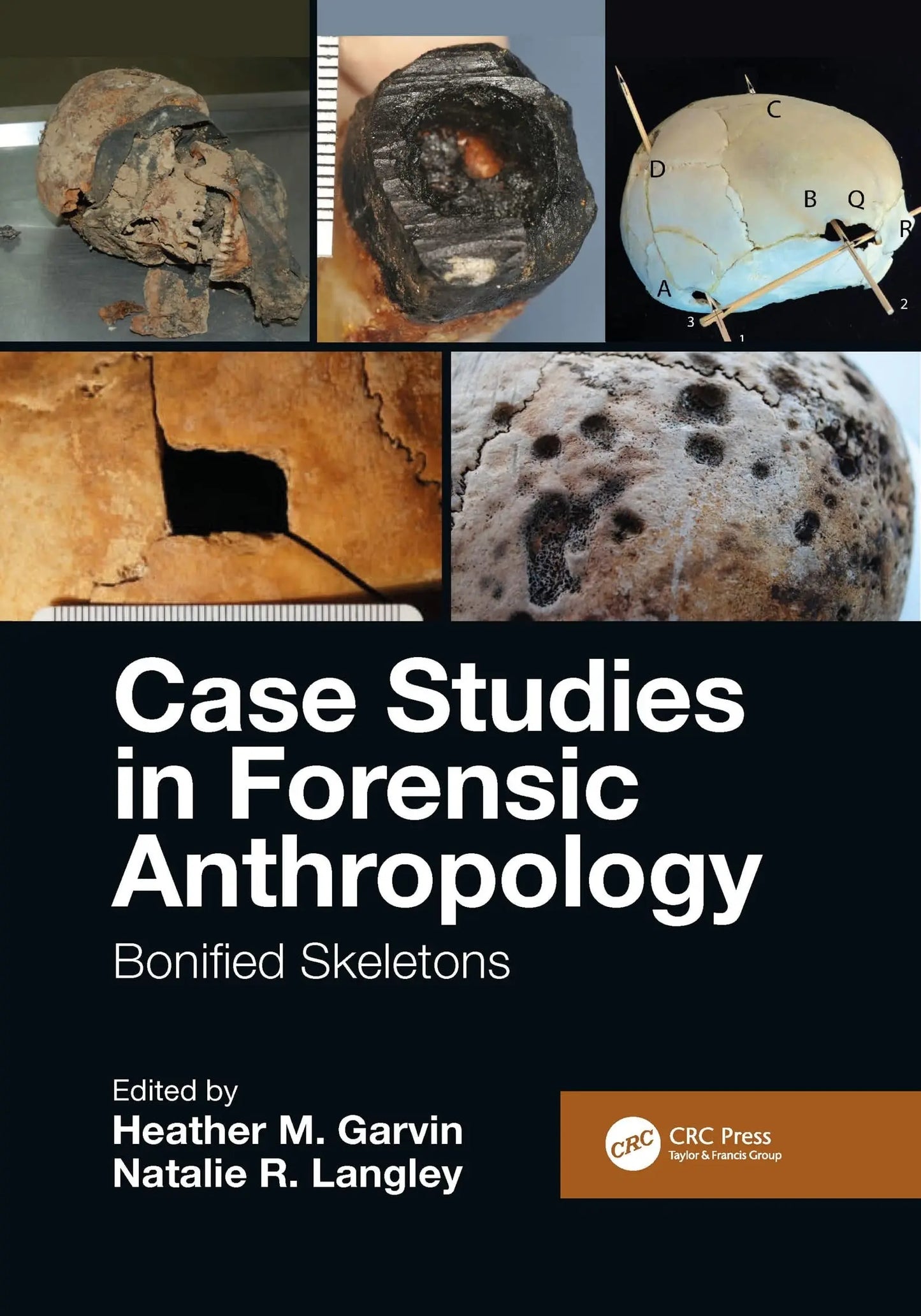 Case Studies in Forensic Anthropology Bonified Skeletons by Heather M. Garvin – book cover