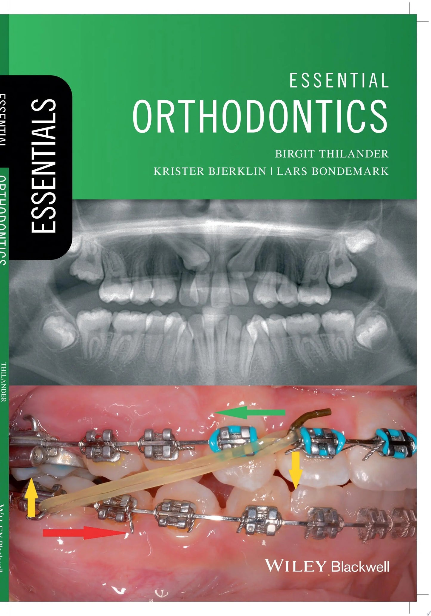 Essential Orthodontics by Birgit Thilander – book cover