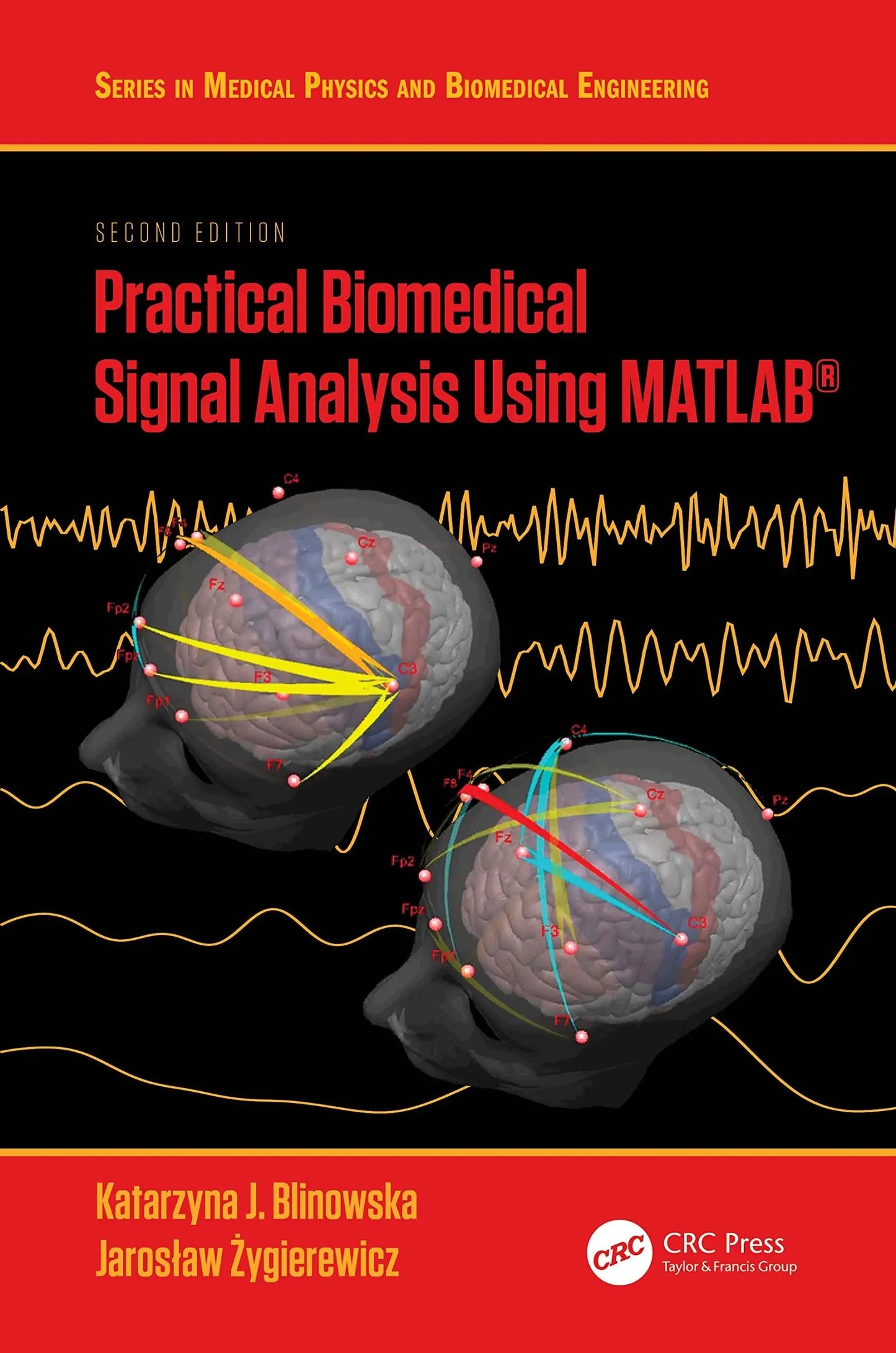 Practical Biomedical Signal Analysis Using MATLAB® by Katarzyna J. Blinowska – book cover