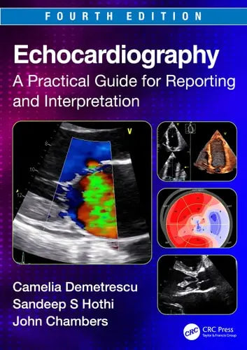 Echocardiography A Practical Guide for Reporting and Interpretation CRC Press