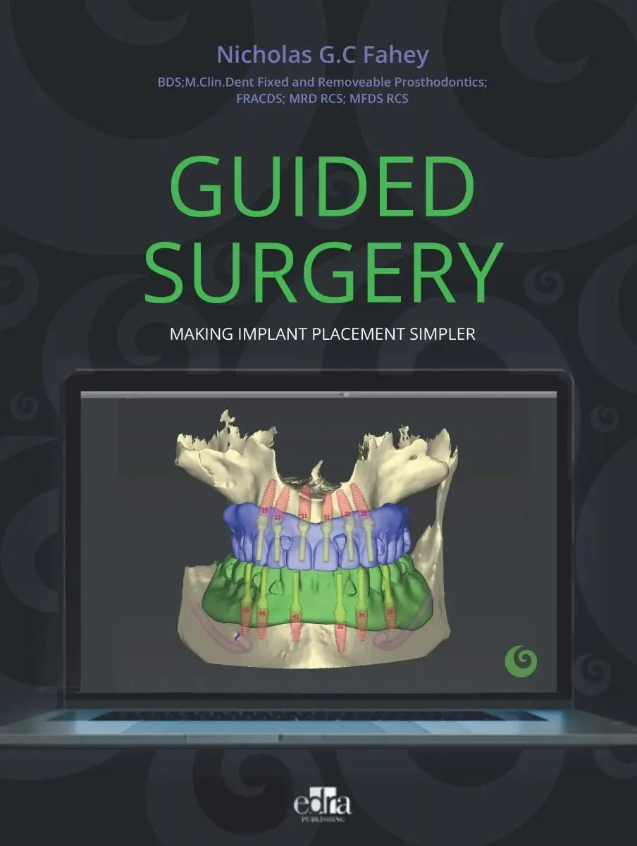 Guided Surgery. Making Implant Placement Simpler by Nicholas G.C. Fahey – book cover