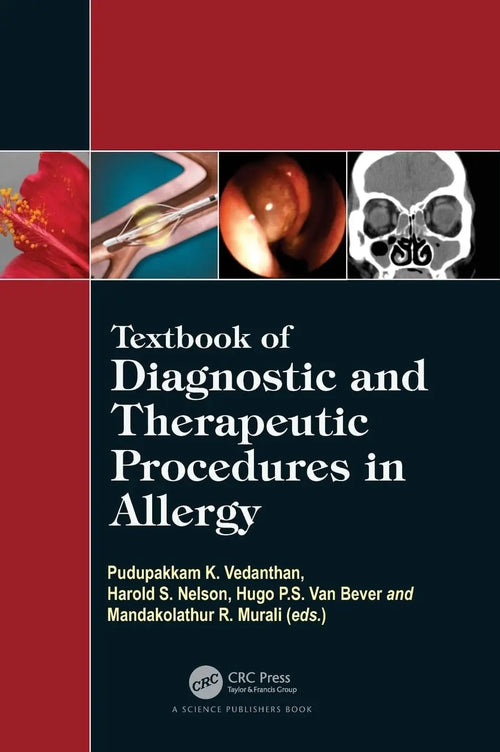 Textbook of Diagnostic and Therapeutic Procedures in Allergy by Pudupakkam K. Vedanthan