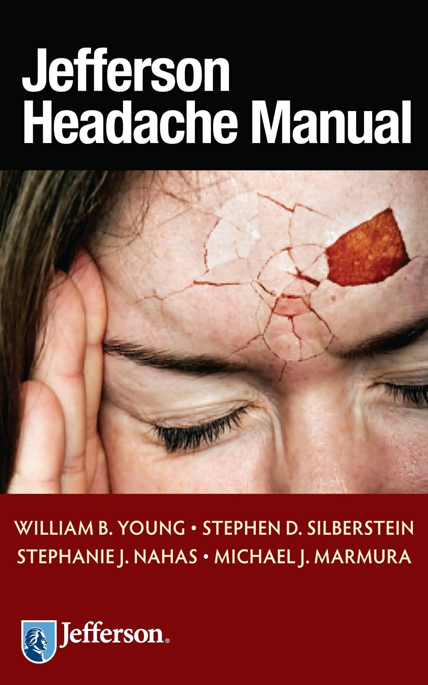 Jefferson Headache Manual by William B. Young – book cover