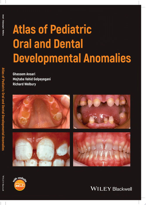 Atlas of Pediatric Oral and Dental Developmental Anomalies