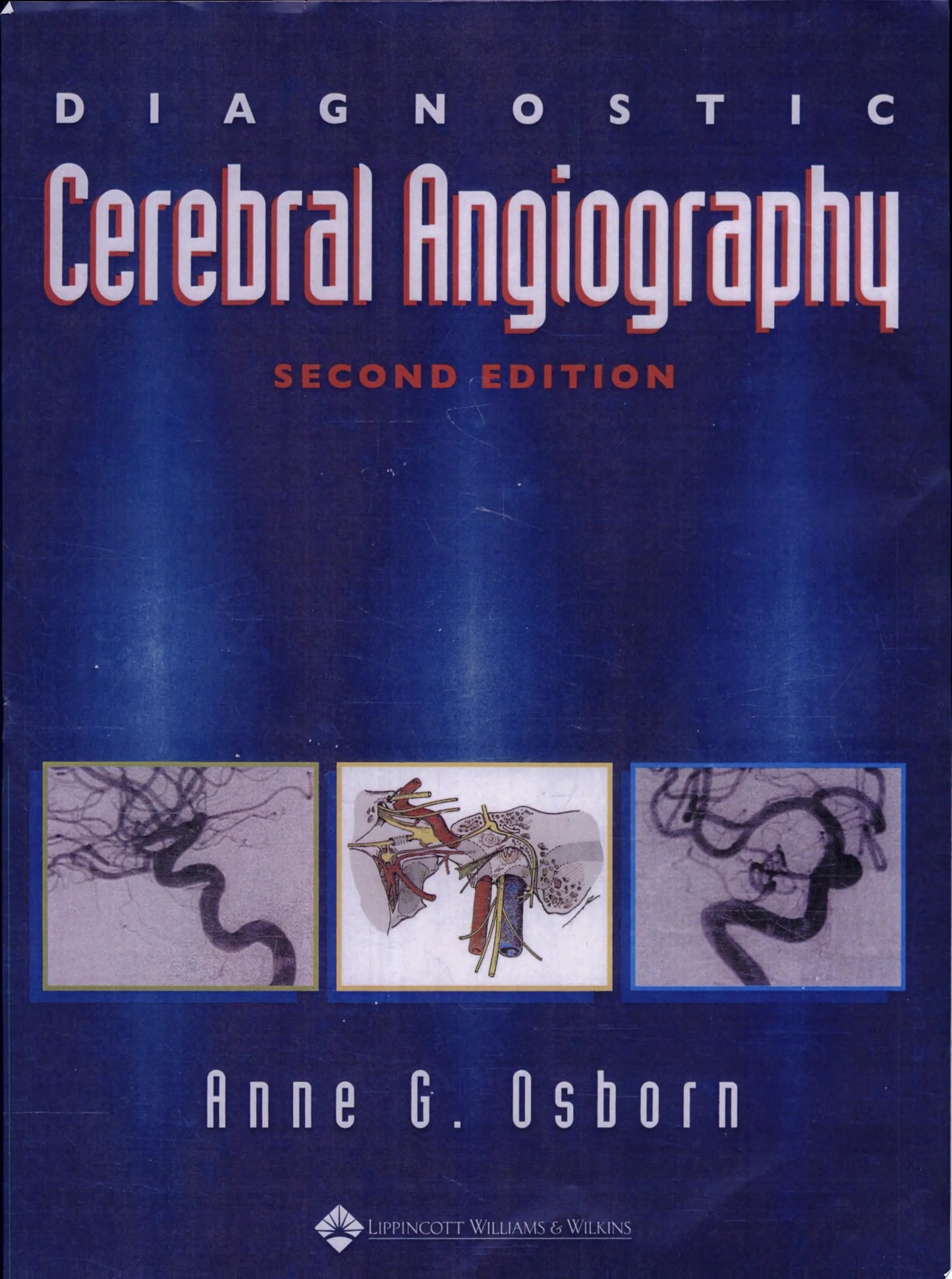 Diagnostic Cerebral Angiography by Anne G. Osborn – book cover