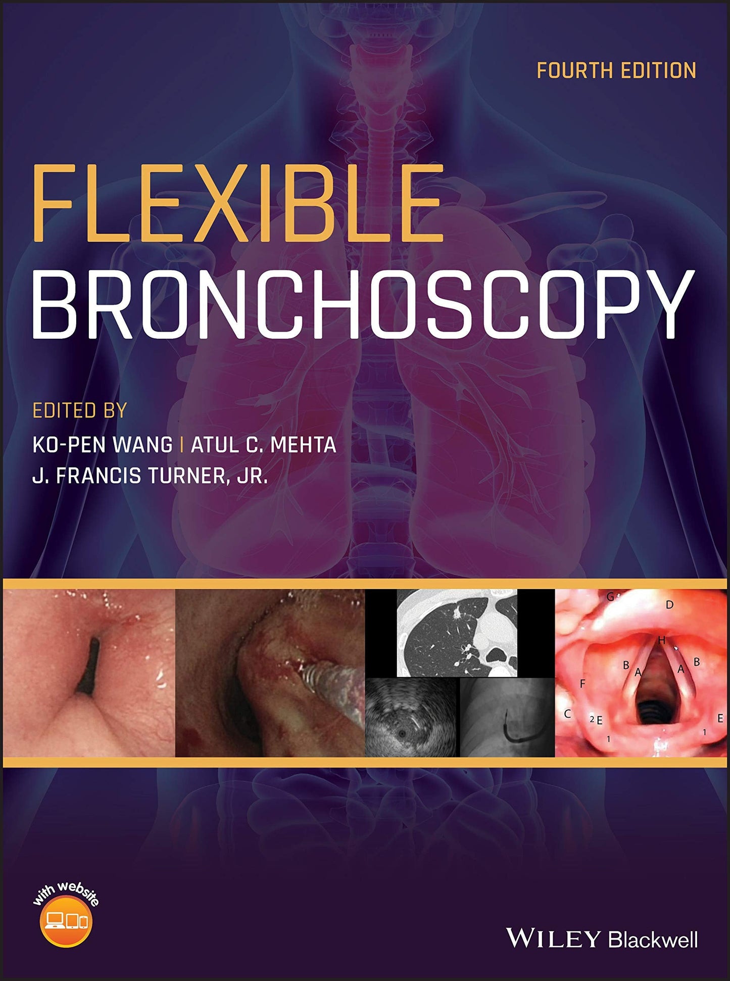 Flexible Bronchoscopy John Wiley & Sons