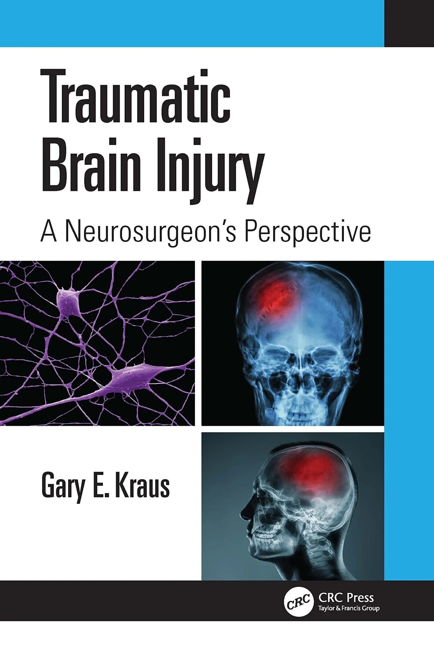 Traumatic Brain Injury A Neurosurgeon's Perspective by Gary Kraus – book cover
