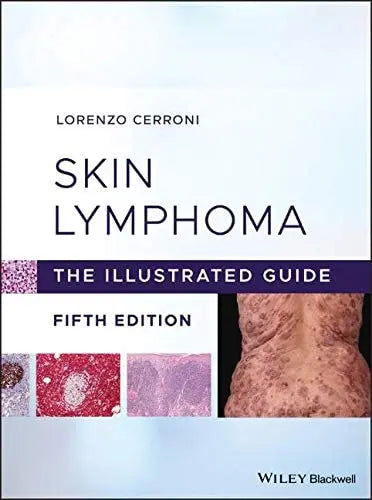 Skin Lymphoma The Illustrated Guide by Lorenzo Cerroni