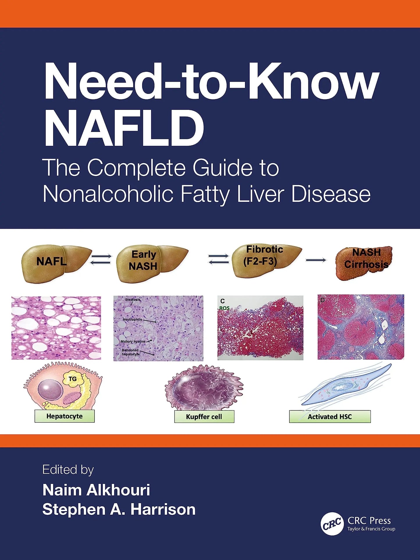 Need-To-Know NAFLD The Complete Guide to Nonalcoholic Fatty Liver Disease by Naim Alkhouri – book cover