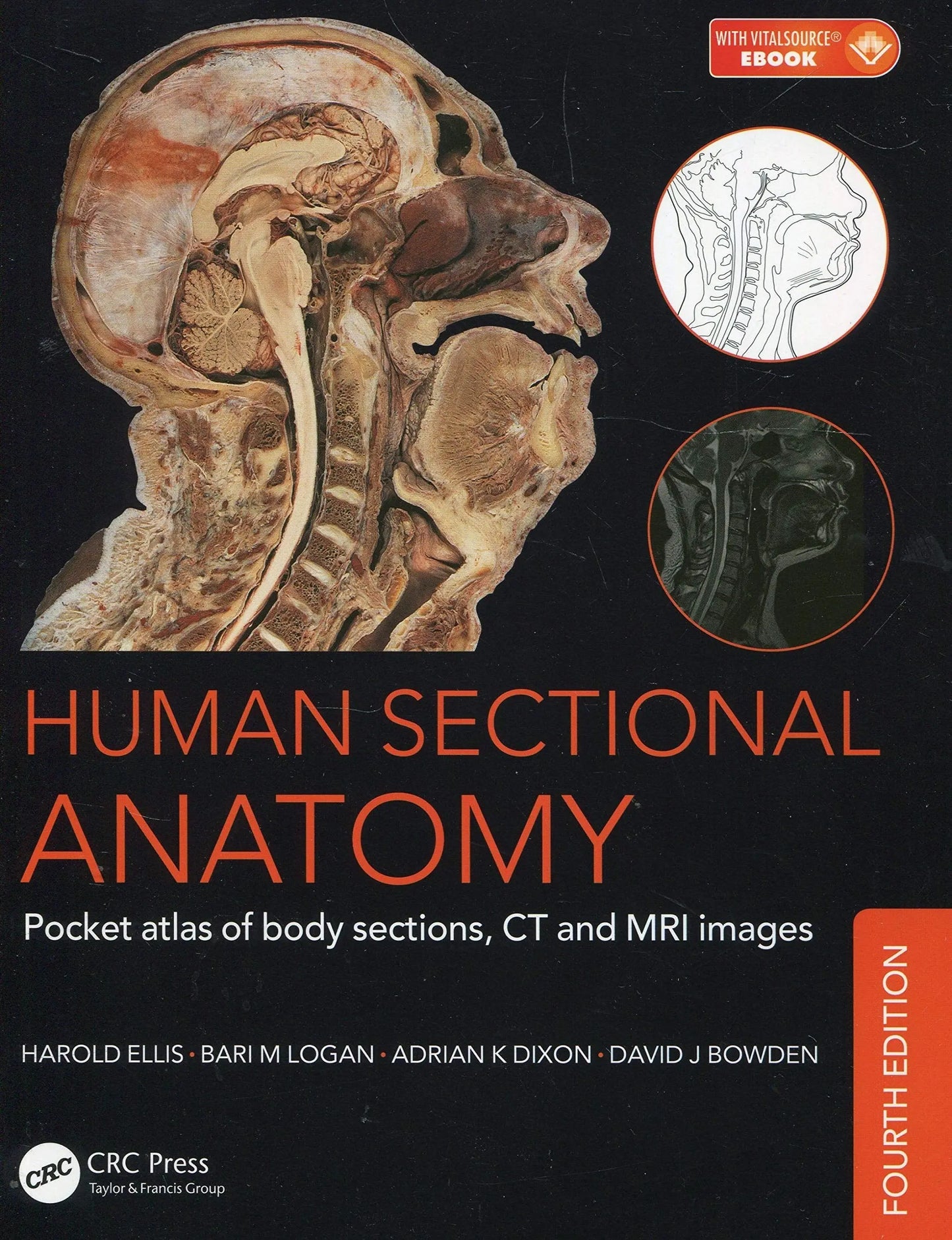 Human Sectional Anatomy Pocket Atlas of Body Sections, CT and MRI Images, Fourth Edition by Adrian Kendal Dixon – book cover