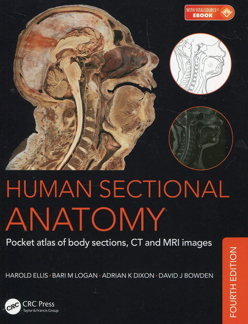Human Sectional Anatomy Pocket Atlas of Body Sections, CT and MRI Images, Fourth Edition by Adrian Kendal Dixon