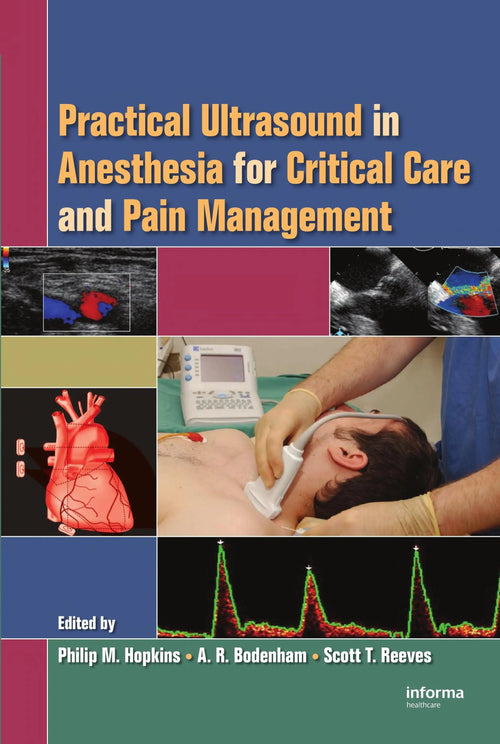 Practical Ultrasound in Anesthesia for Critical Care and Pain Management by Philip M. Hopkins