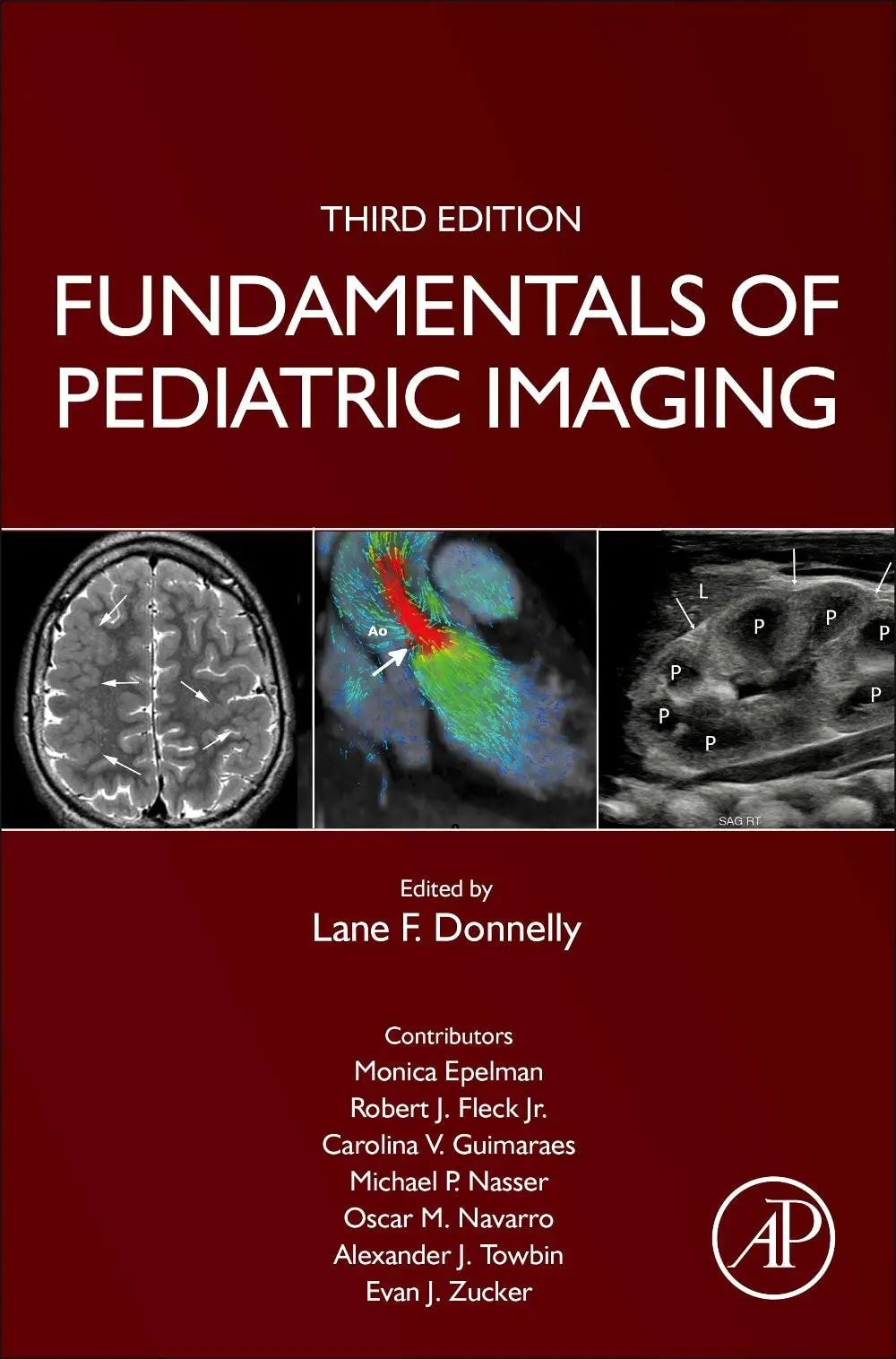 Fundamentals of Pediatric Imaging by Lane F. Donnelly – book cover