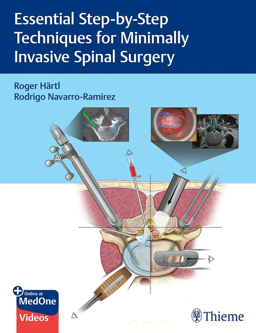 Essential Step-By-Step Techniques for Minimally Invasive Spinal Surgery by Roger Hartl – book cover