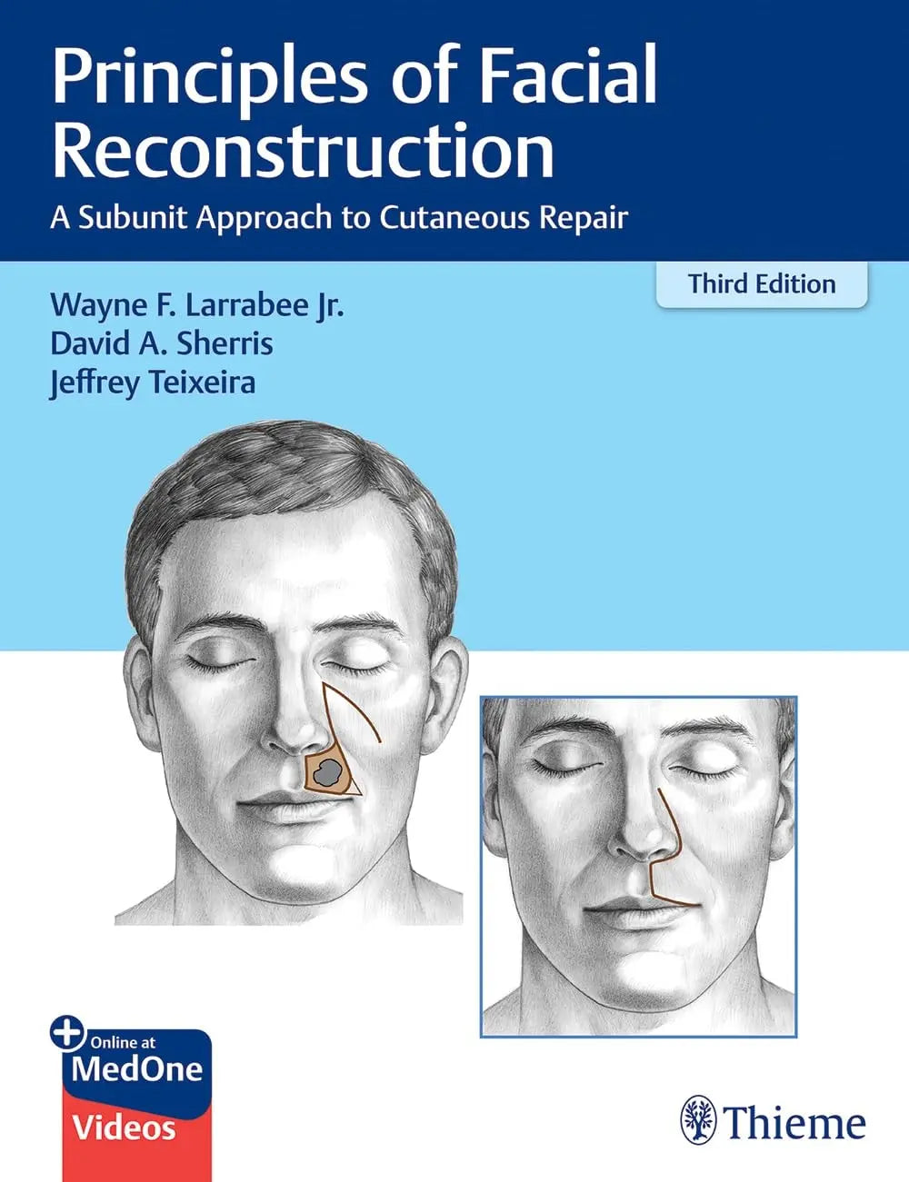 Principles of Facial Reconstruction A Subunit Approach to Cutaneous Repair by Wayne F. Larrabee – book cover