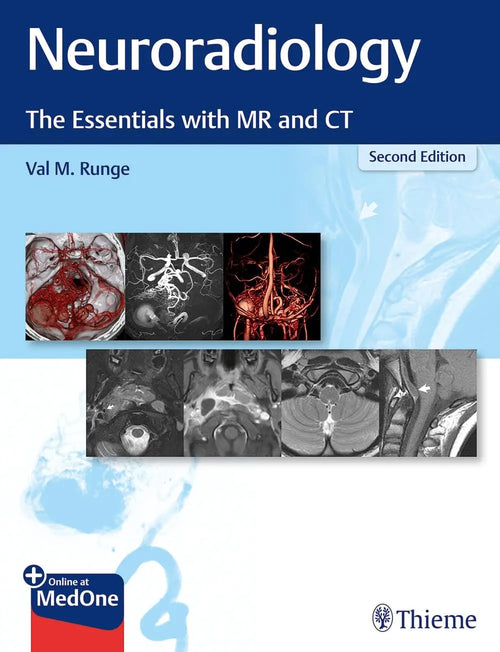 Neuroradiology The Essentials with MR and CT by Val M. Runge