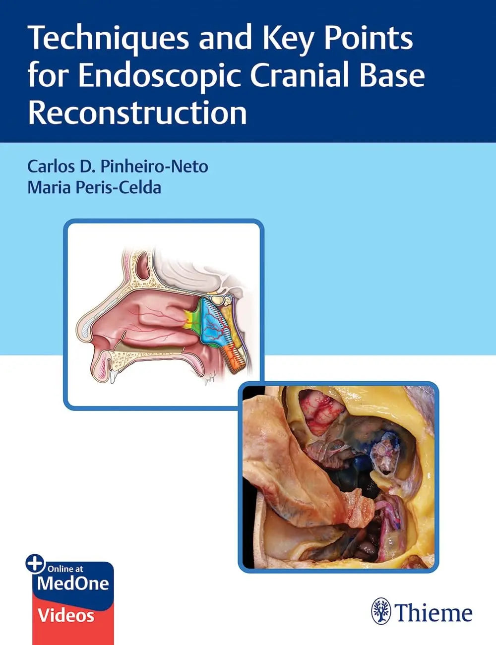 Techniques and Key Points for Endoscopic Cranial Base Reconstruction by Carlos Pinheiro-Neto – book cover