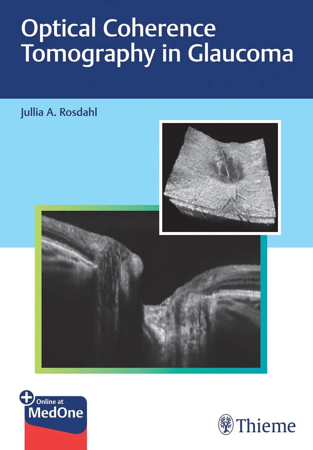 Optical Coherence Tomography in Glaucoma by Jullia Rosdahl – book cover