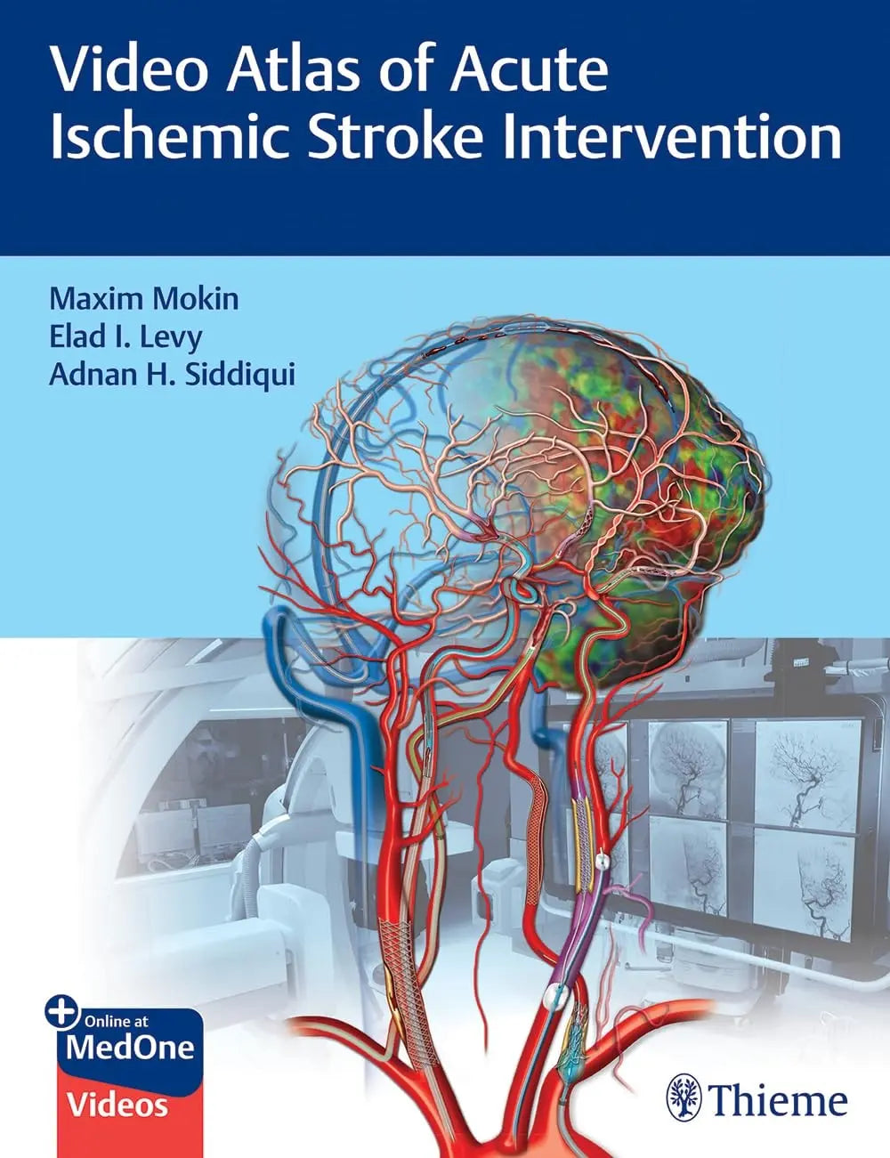Video Atlas of Acute Ischemic Stroke Intervention by Maxim Mokin – book cover