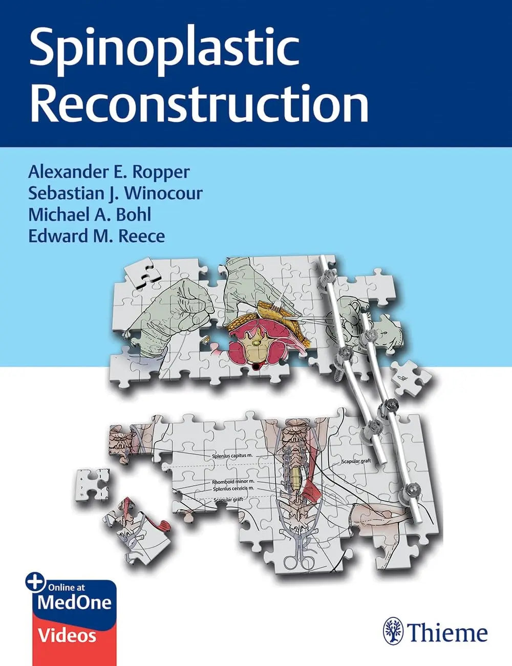 Spinoplastic Reconstruction by Alexander Ropper – book cover