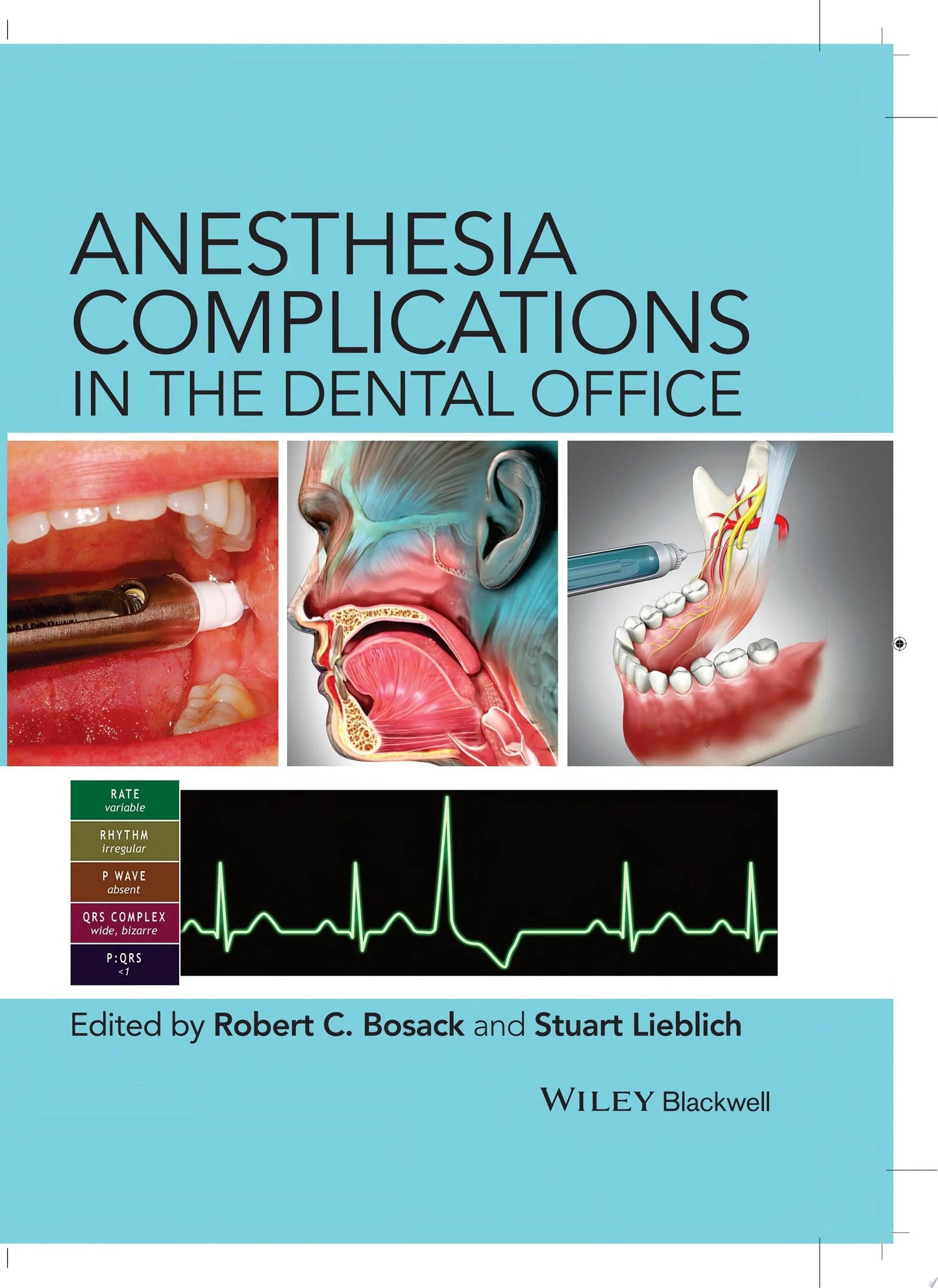 Anesthesia Complications in the Dental Office by Robert C. Bosack – book cover