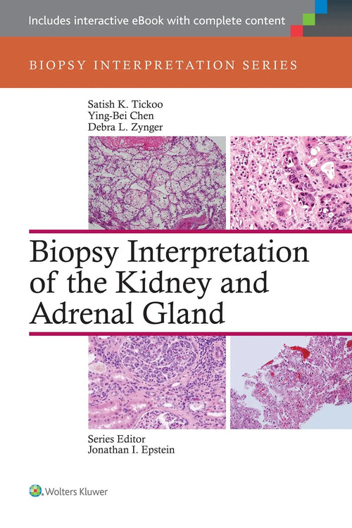 Biopsy Interpretation of the Kidney and Adrenal Gland by Satish K. Tickoo