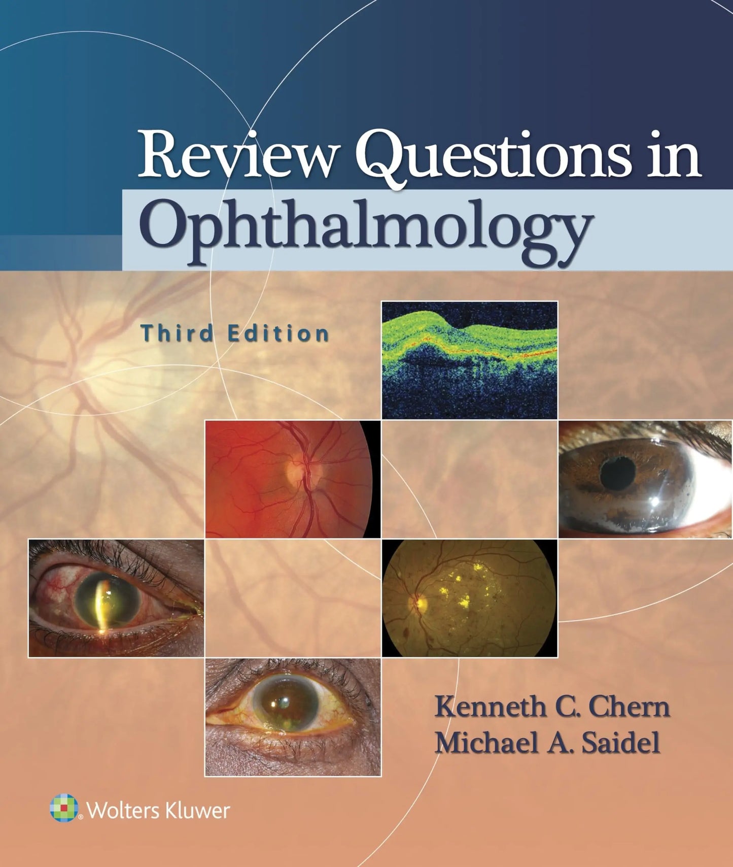 Review Questions in Ophthalmology by Kenneth C. Chern – book cover