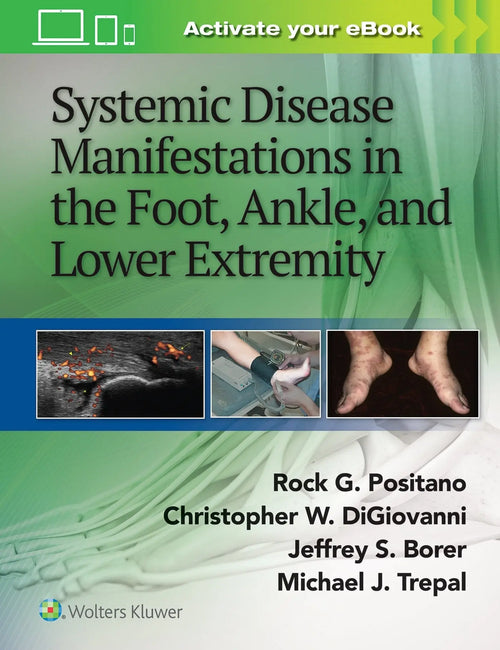 Systemic Disease Manifestations in the Foot, Ankle and Lower Extremity by Rock G. Positano