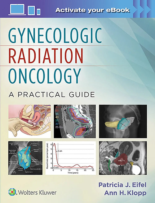 Gynecologic Radiation Oncology A Practical Guide by Patricia Eifel