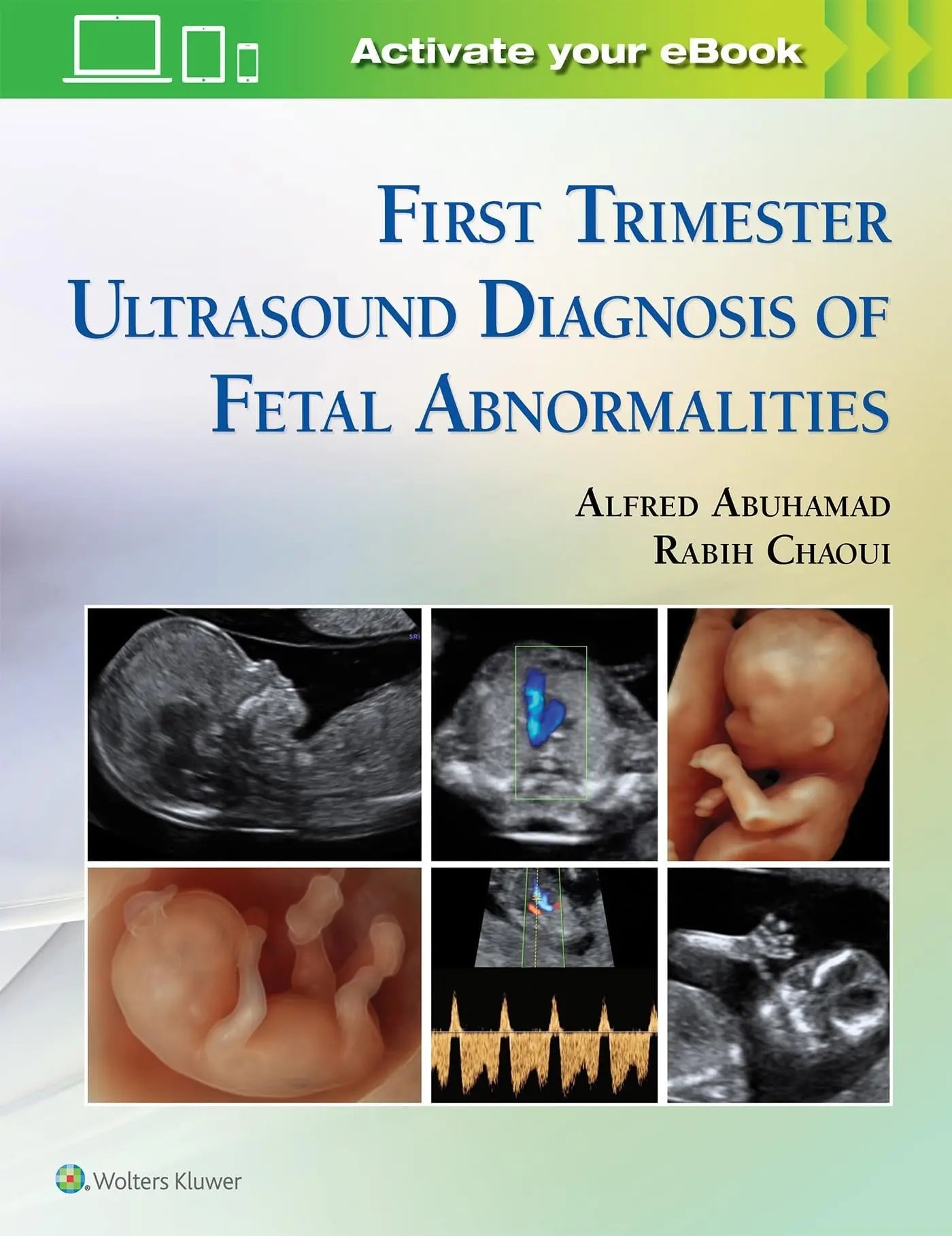 First Trimester Ultrasound Diagnosis of Fetal Abnormalities by Alfred Abuhamad – book cover