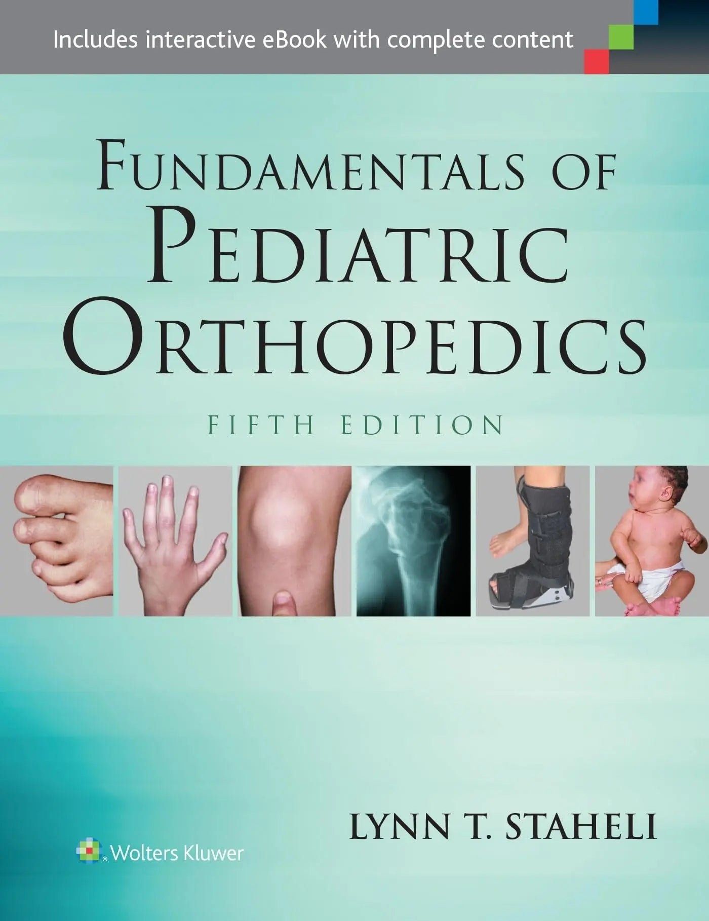 Fundamentals of Pediatric Orthopedics by Lynn T. Staheli – book cover