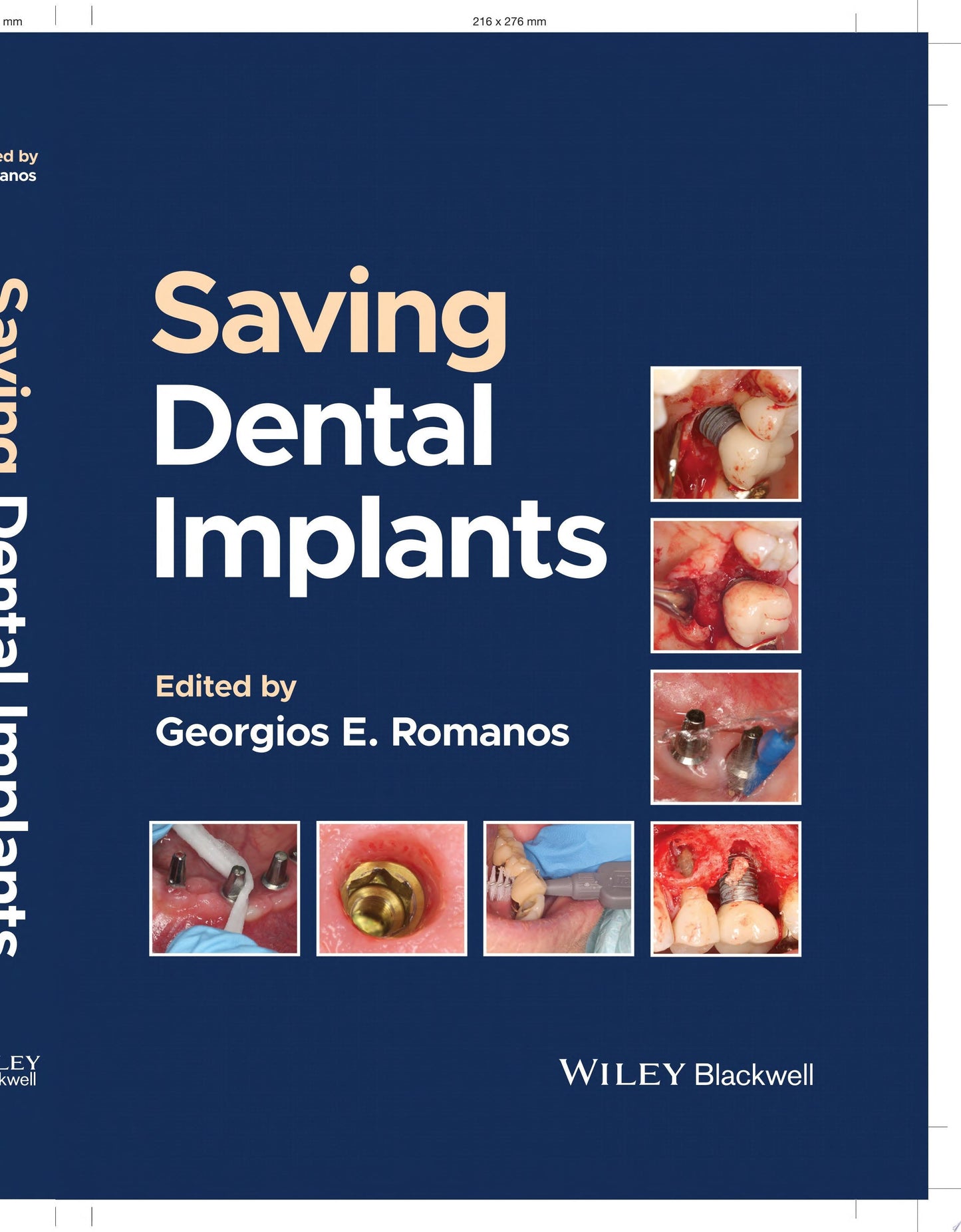 Saving Dental Implants John Wiley & Sons