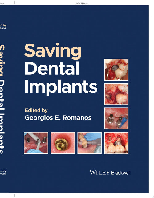 Saving Dental Implants
