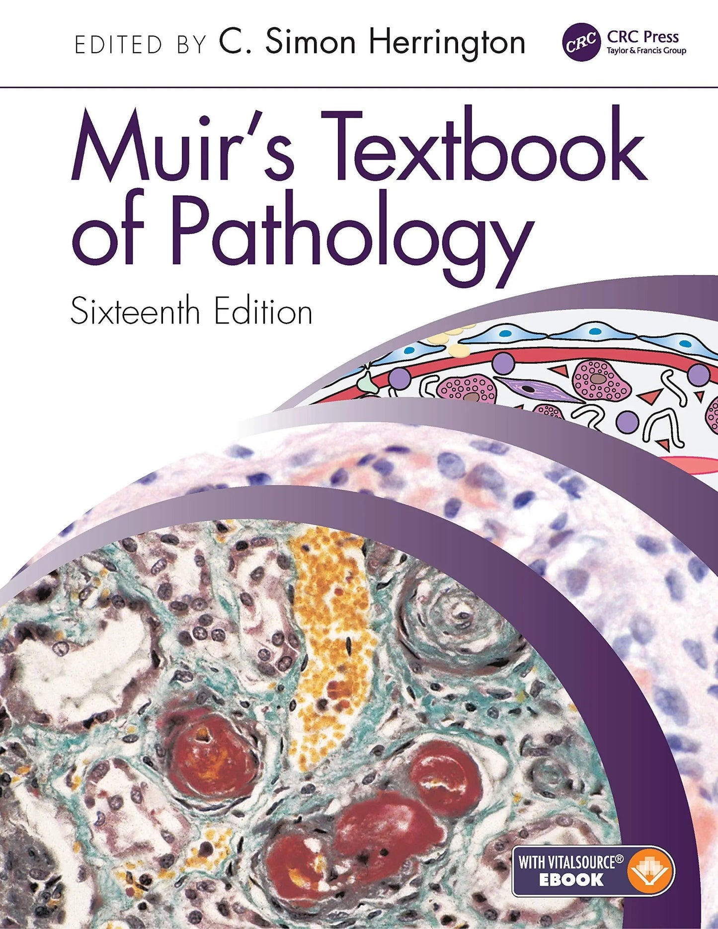Muir's Textbook of Pathology by C. Simon Herrington – book cover