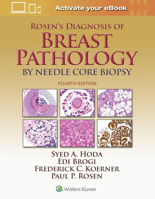 Rosen's Diagnosis of Breast Pathology by Needle Core Biopsy by Syed A. Hoda