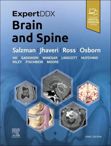 ExpertDDx: Brain and Spine Elsevier