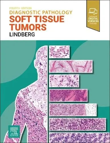 Diagnostic Pathology: Soft Tissue Tumors Elsevier