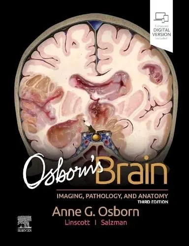 Osborn's Brain Elsevier