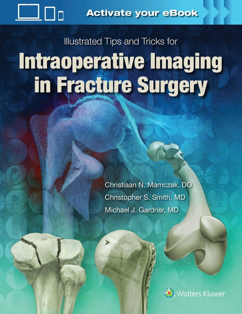 Illustrated Tips and Tricks for Intraoperative Imaging in Fracture Surgery by Christiaan N. Mamczak