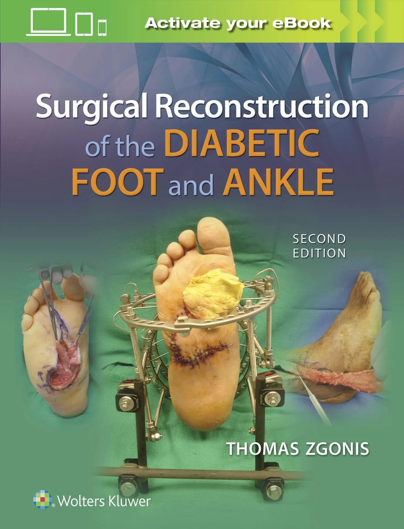 Surgical Reconstruction of the Diabetic Foot and Ankle by Thomas Zgonis – book cover
