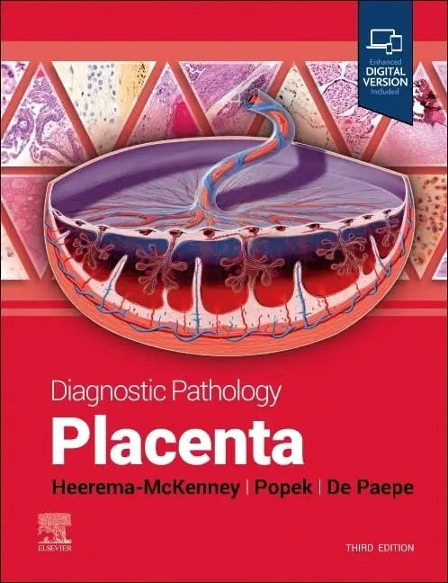 Diagnostic Pathology: Placenta by Amy Heerema-McKenney – book cover