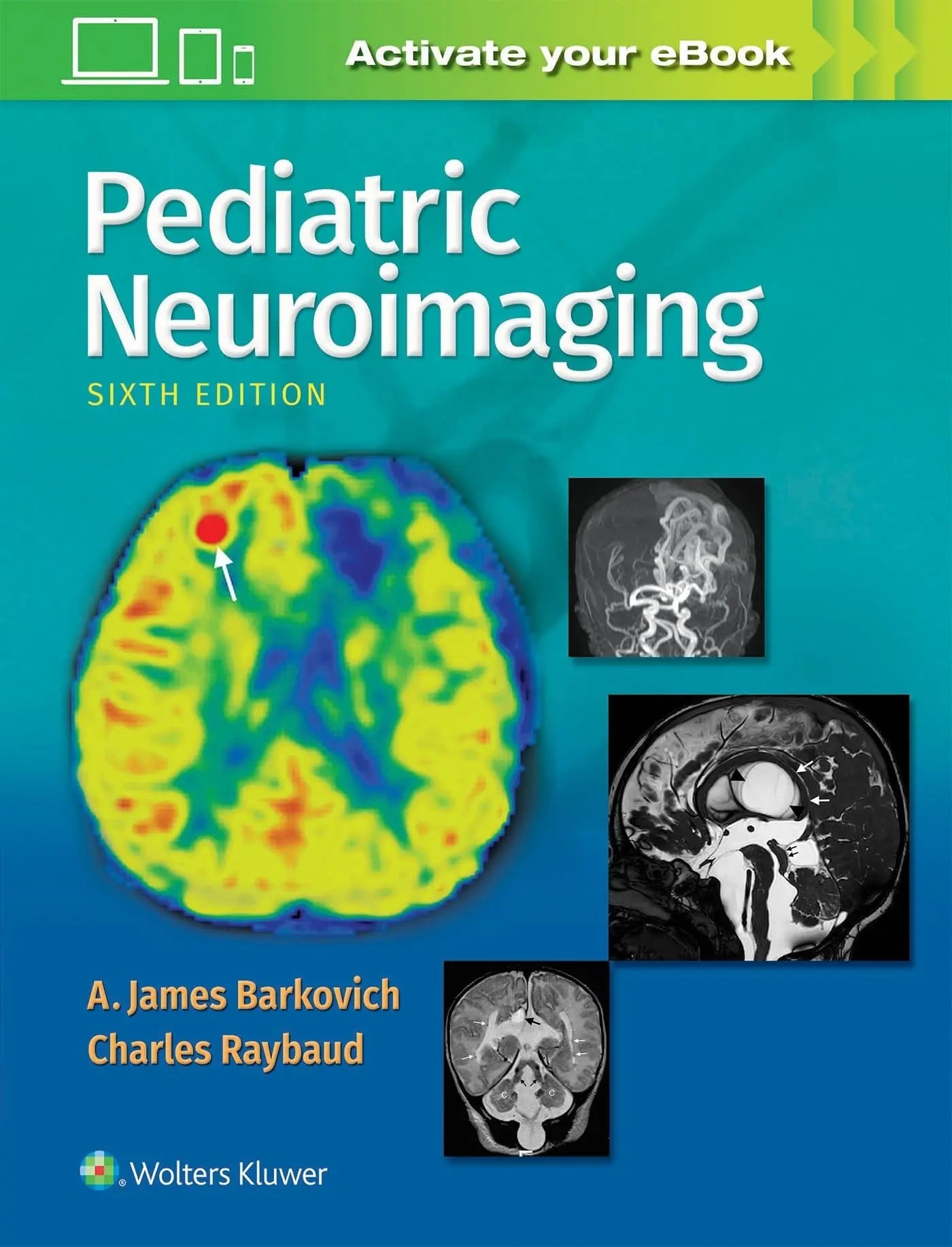Pediatric Neuroimaging by A. James Barkovich – book cover