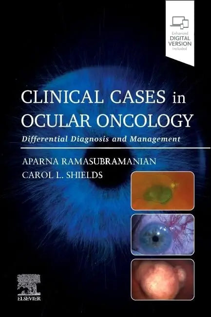 Clinical Cases in Ocular Oncology Differential Diagnosis and Management by Aparna Ramasubramanian – book cover