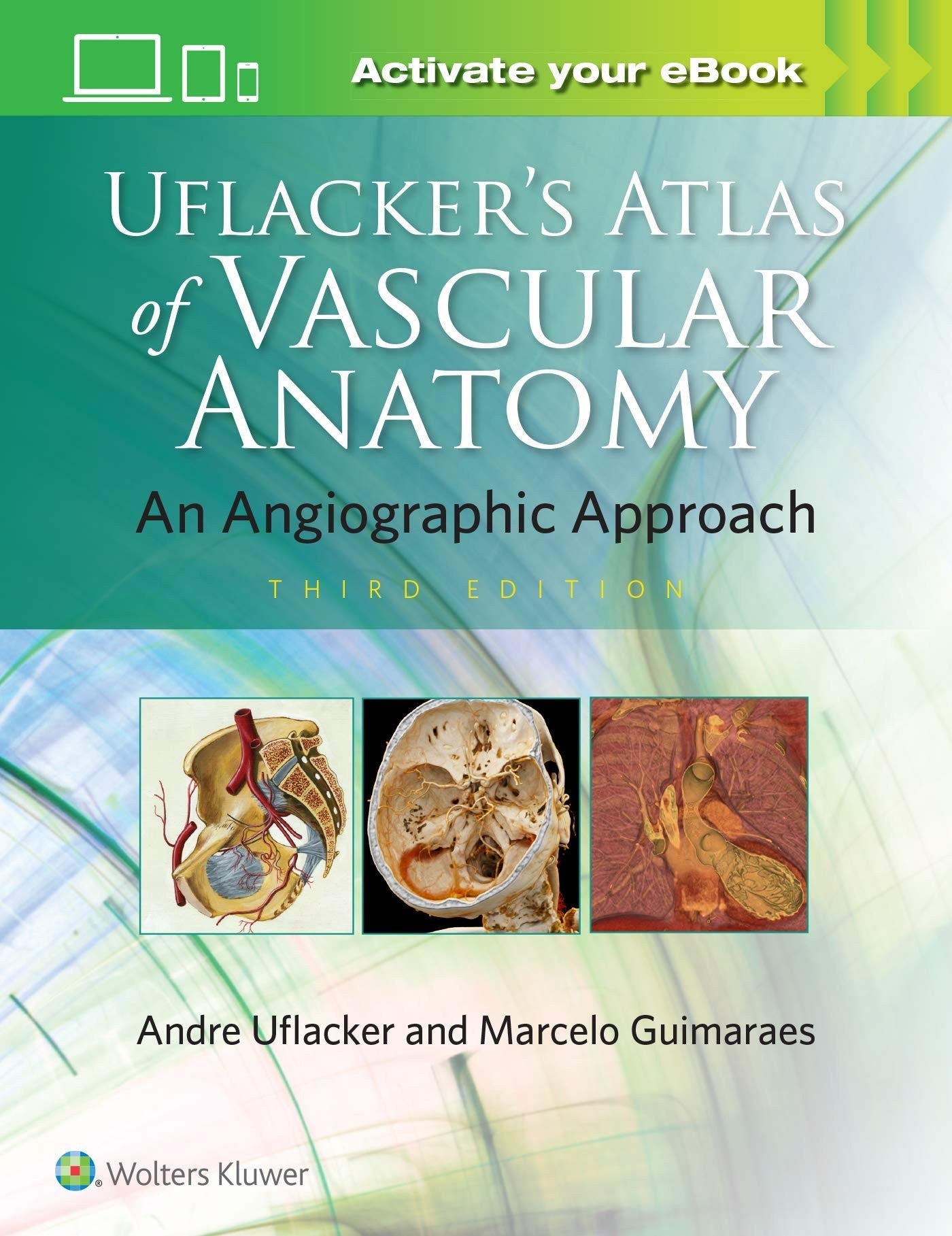 Uflacker's Atlas of Vascular Anatomy An Angiographic Approach Wolters Kluwer