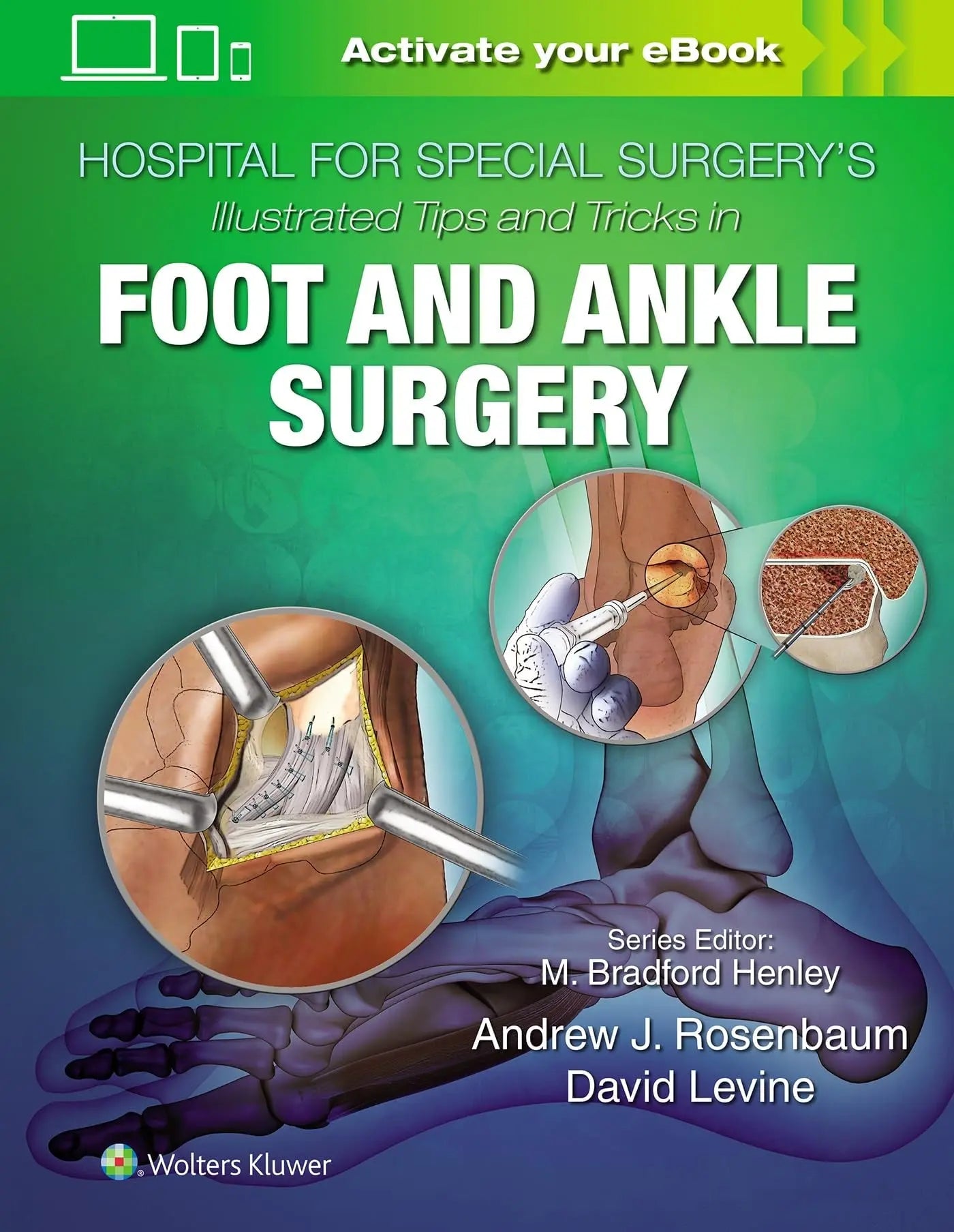 Hospital for Special Surgery's Illustrated Tips and Tricks in Foot and Ankle Surgery by David Levine – book cover