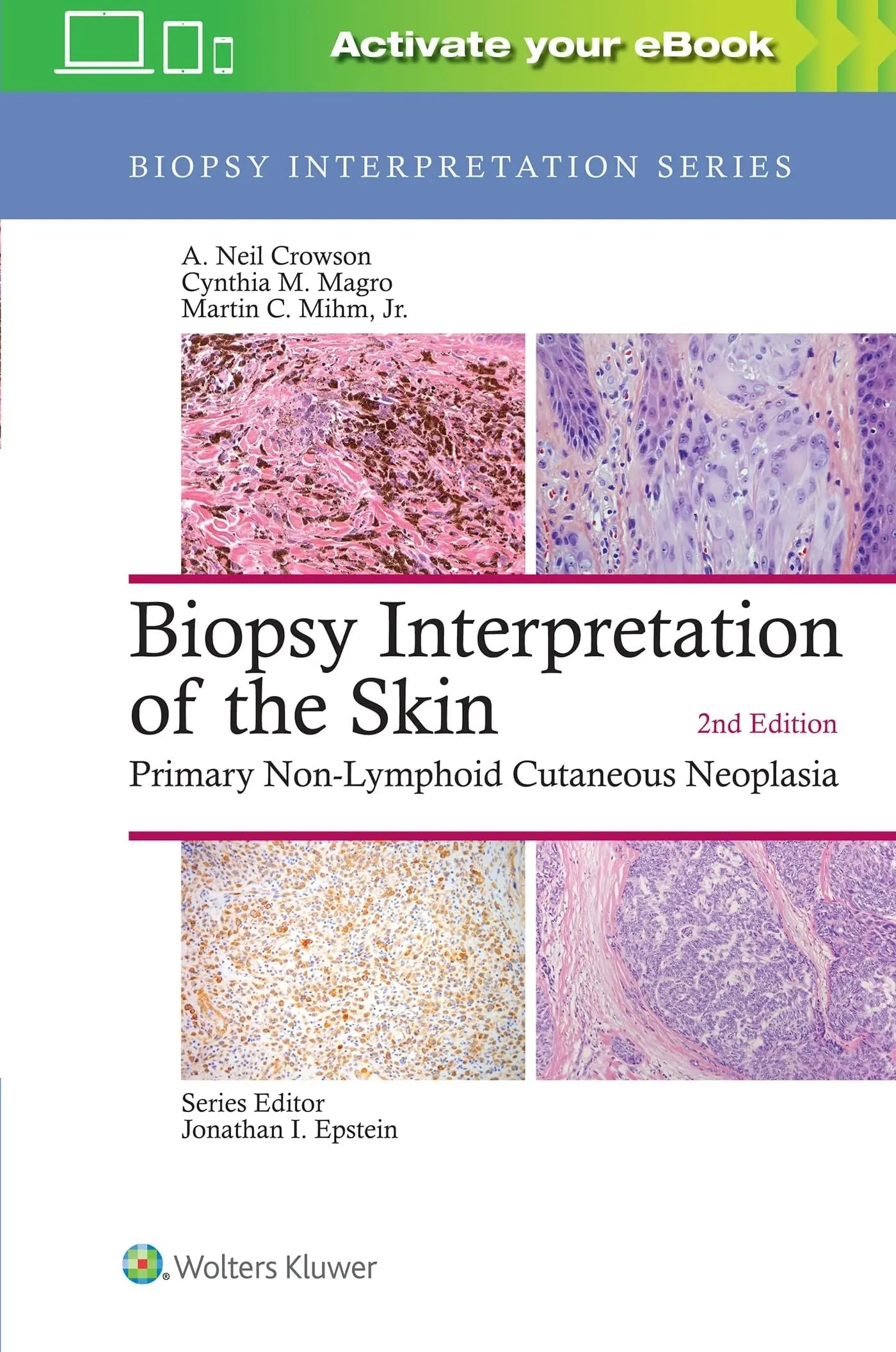 Biopsy Interpretation of the Skin Primary Non-Lymphoid Cutaneous Neoplasia by A. Neil Crowson – book cover